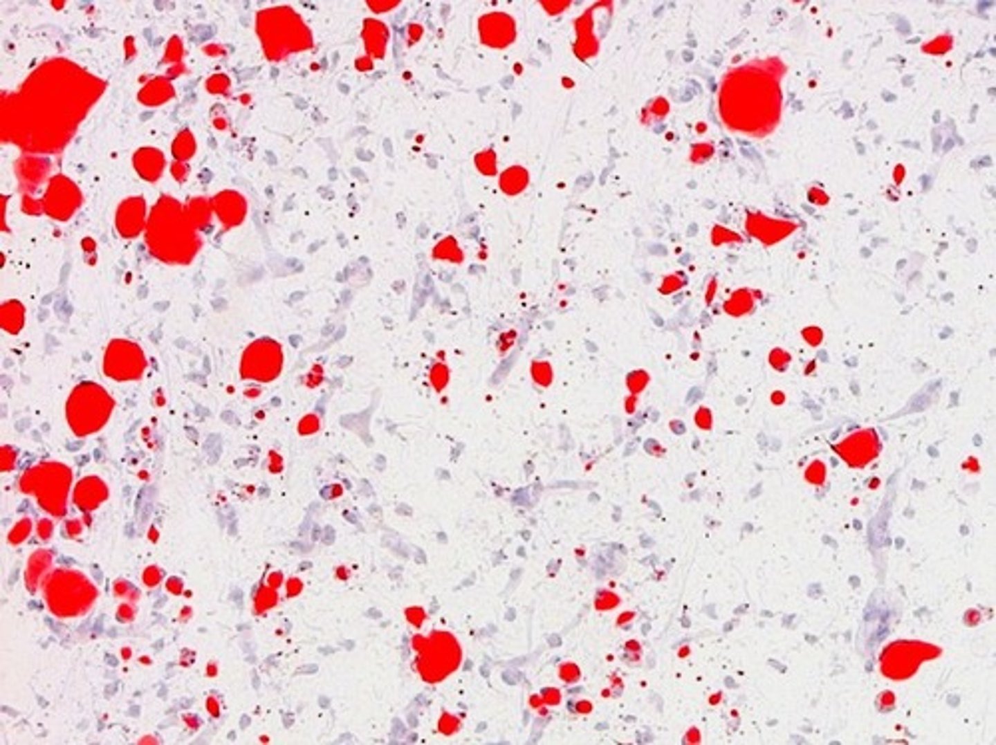 <p>Identify free fat droplets and lipidcontaining cells and casts</p>