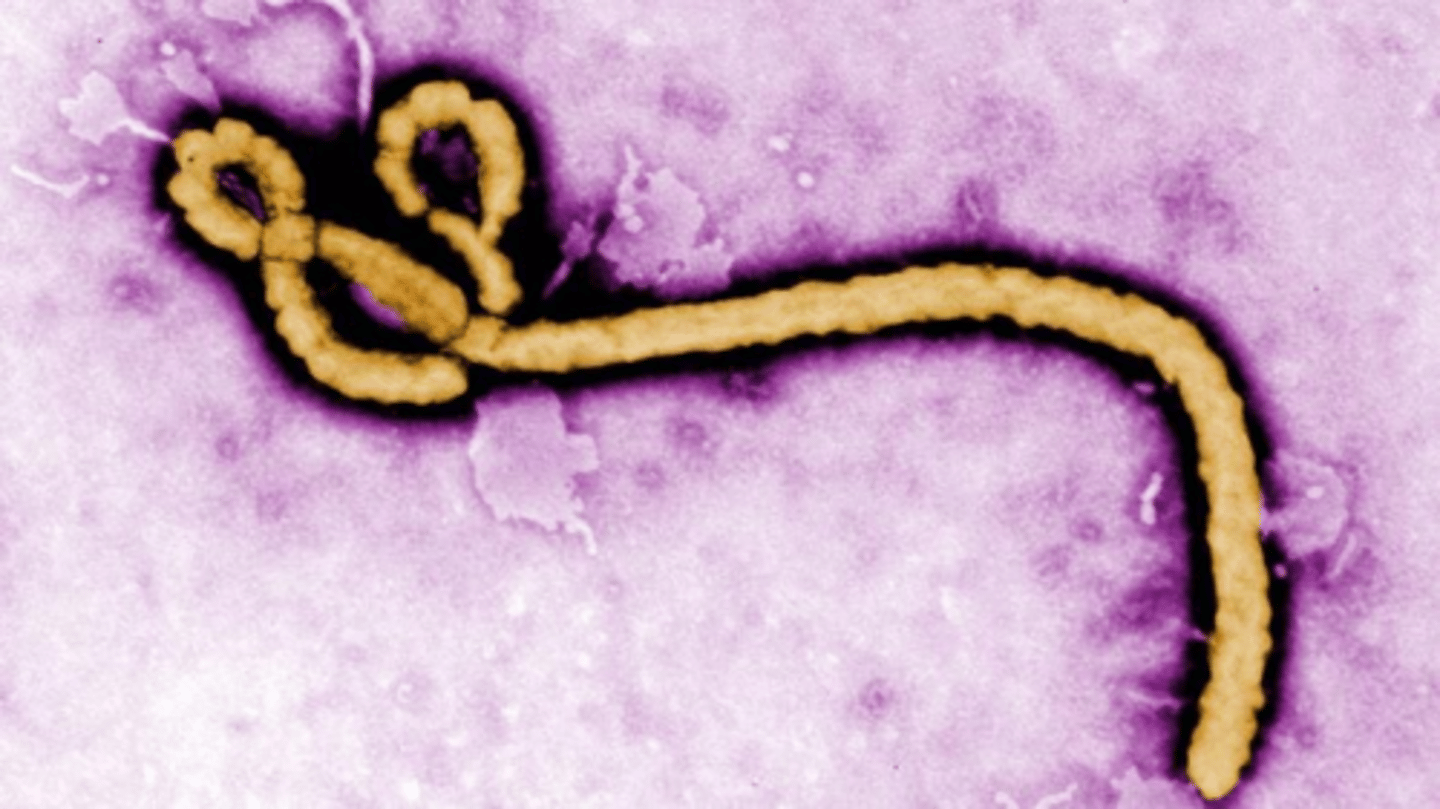 <p>Orthoebolavirus, a member of the Filovirus family.</p>