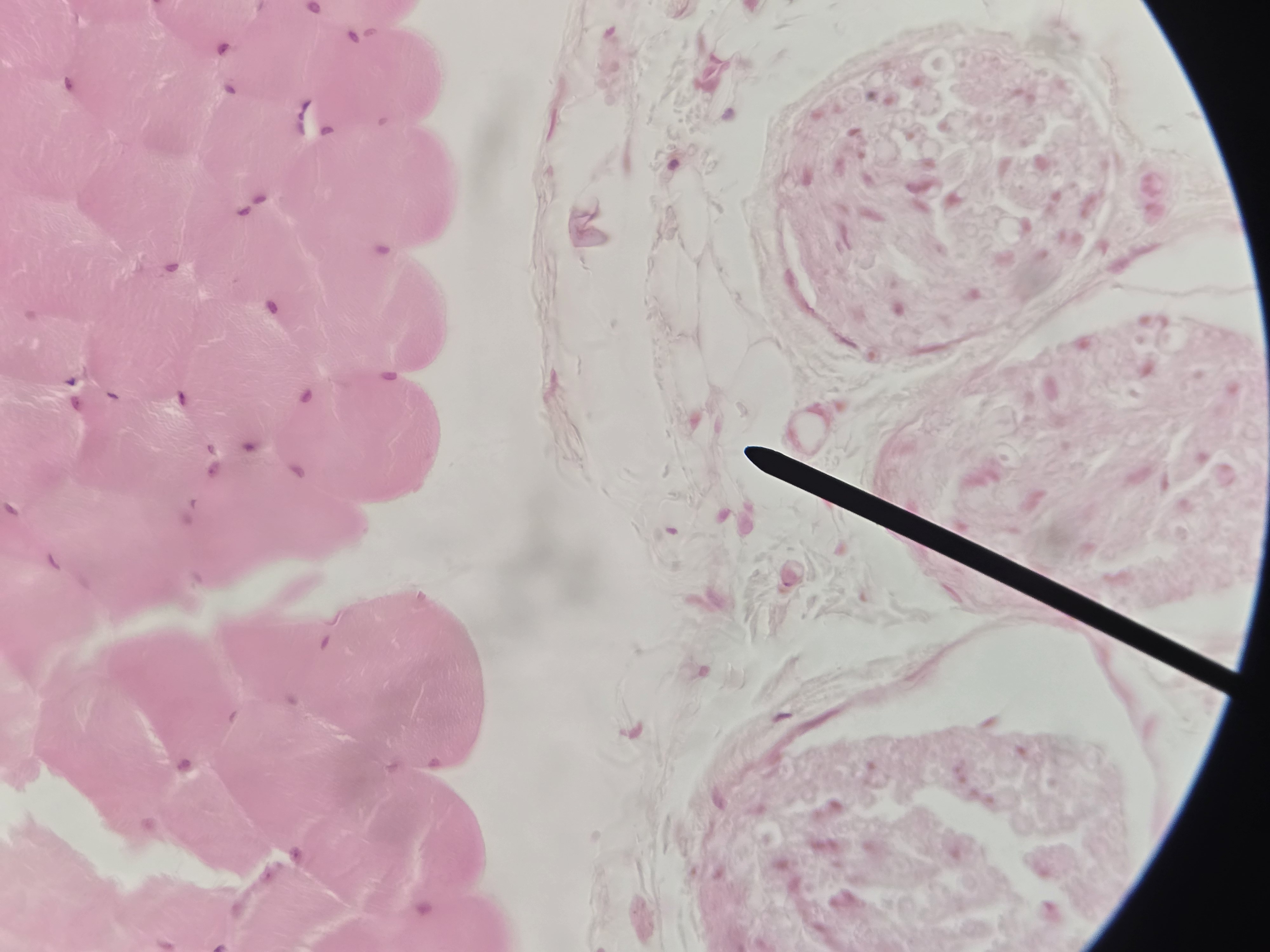 <p>Name Connective Tissue Layer</p>