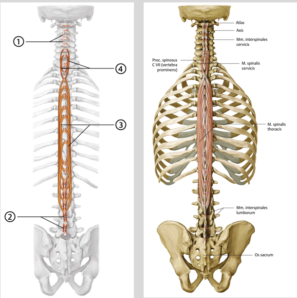 <p><span><span><br> Origo:<br></span></span><span data-name="black_small_square" data-type="emoji">▪</span><span><span> Thoracis: zijvlak proc. spinosus van Th X-XII<br>en L I-III<br></span></span><span data-name="black_small_square" data-type="emoji">▪</span><span><span> Cervicis: proc. spin. van Th I-II en C V-VII<br></span></span><span data-name="black_small_square" data-type="emoji">▪</span><span><span> Capitis: proc. spin. Van TI-II en C V-VII</span></span></p><p><span><span><br></span></span><span data-name="black_small_square" data-type="emoji">▪</span><span><span> Insertie:<br></span></span><span data-name="black_small_square" data-type="emoji">▪</span><span><span> Thoracis: zijvlak proc. spin. van Th II-VII<br></span></span><span data-name="black_small_square" data-type="emoji">▪</span><span><span> Cervicis: proc. spin. van C II-IV.<br></span></span><span data-name="black_small_square" data-type="emoji">▪</span><span><span> Capitis: tussen linea nuchalis suprema en<br>linea nuchalis superior.</span></span></p><p><span><span><br></span></span><span data-name="black_small_square" data-type="emoji">▪</span><span><span> Functie:<br></span></span><span data-name="black_small_square" data-type="emoji">▪</span><span><span> Extensie, homolaterale lateroflexie en<br>rotatie van ThWK, CWK, en hoofd.</span></span></p><p><span><span><br></span></span><span data-name="black_small_square" data-type="emoji">▪</span><span><span> Innervatie:<br></span></span><span data-name="black_small_square" data-type="emoji">▪</span><span><span> rr. Dorsales spinale zenuwen</span></span></p><p><span><span><br></span></span></p>