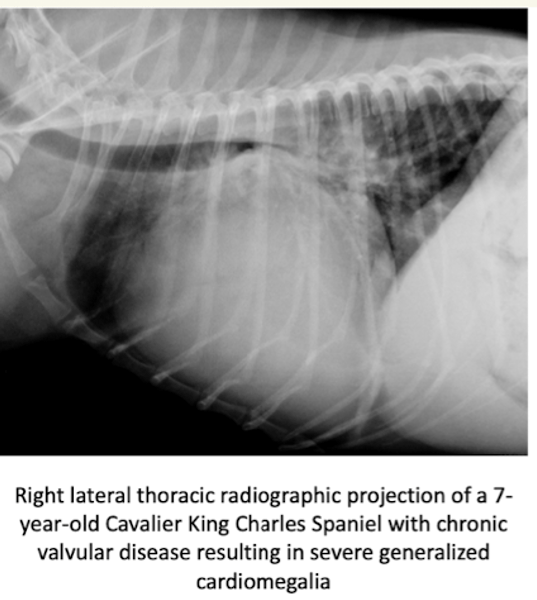 <p>- distensión venosa pulmonar</p><p>- edema pulmonar intersticial</p><p>- cambios en la silueta cardiaca: hipertrofia/ dilatación</p>