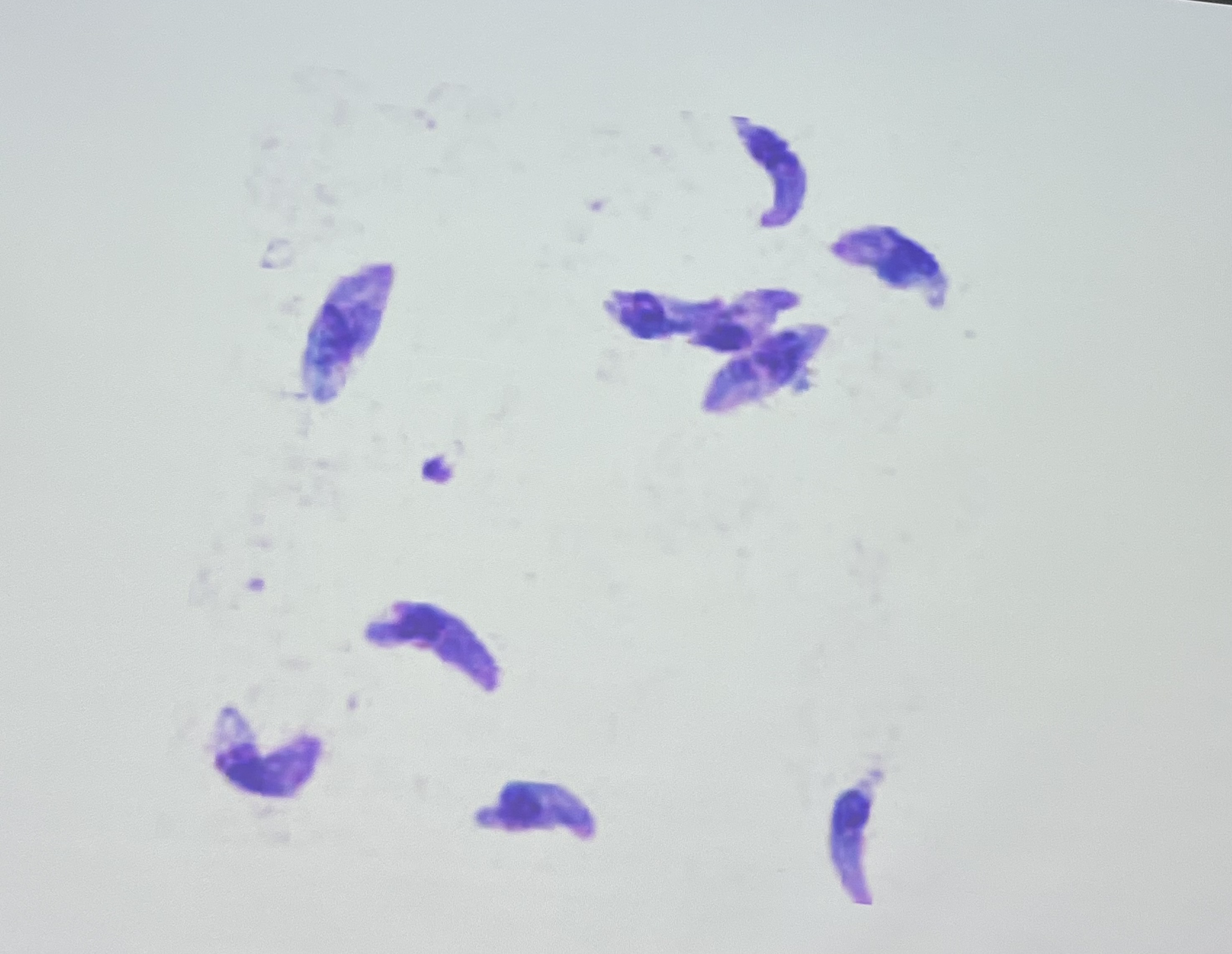 <p>Tachyzoites: banana shaped cells, prominent nucleus </p>