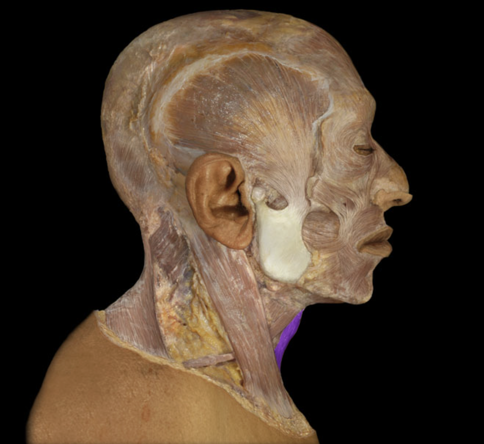 <p>What muscle is this?</p>