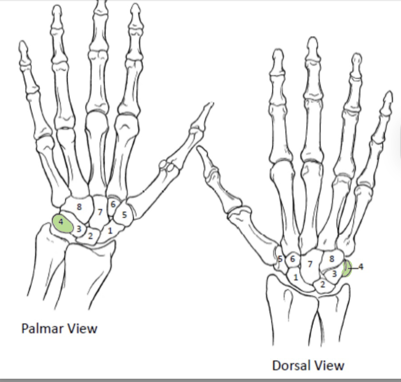 <p>Which Carpal Bones from the proximal row are shown(4)?</p>