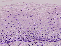 <p>Structure: <br />
-Cuboidal basement with squamous top layer <br />
-Cell division in basal layer<br />
-Keratinized or not</p>