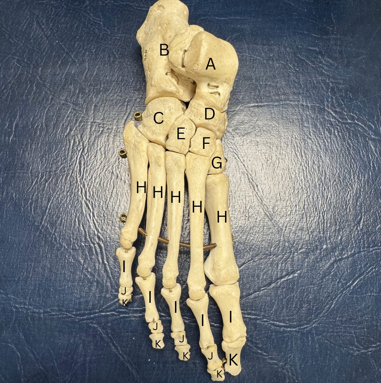 <p>Label all the bones of the foot A-K</p>