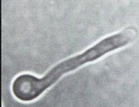 <p>What is the result of this germ tube? </p>