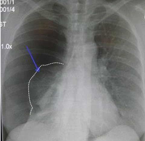 <p>diagnosis</p>