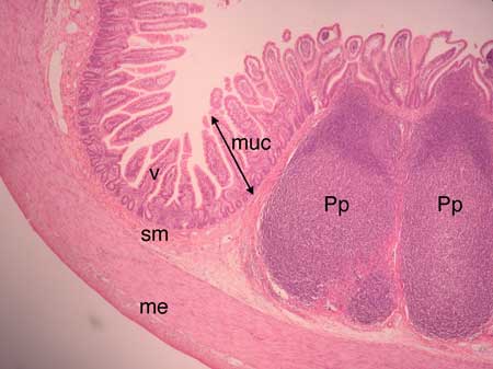 <p>Peyer’s patches </p>