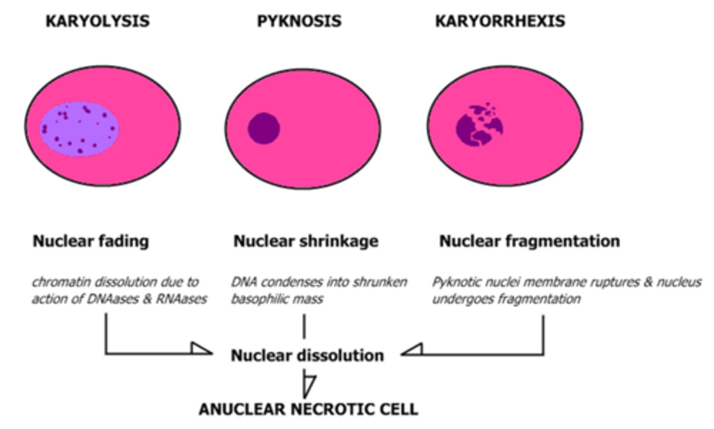 <p>nuclear shrinkage, increased basophilia</p><p>chromatin condenses into solid shrunken basophilic mass</p>