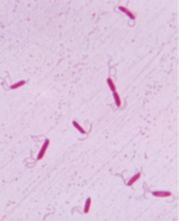<p>tufts of multiple flagella at 1 or both sides</p>