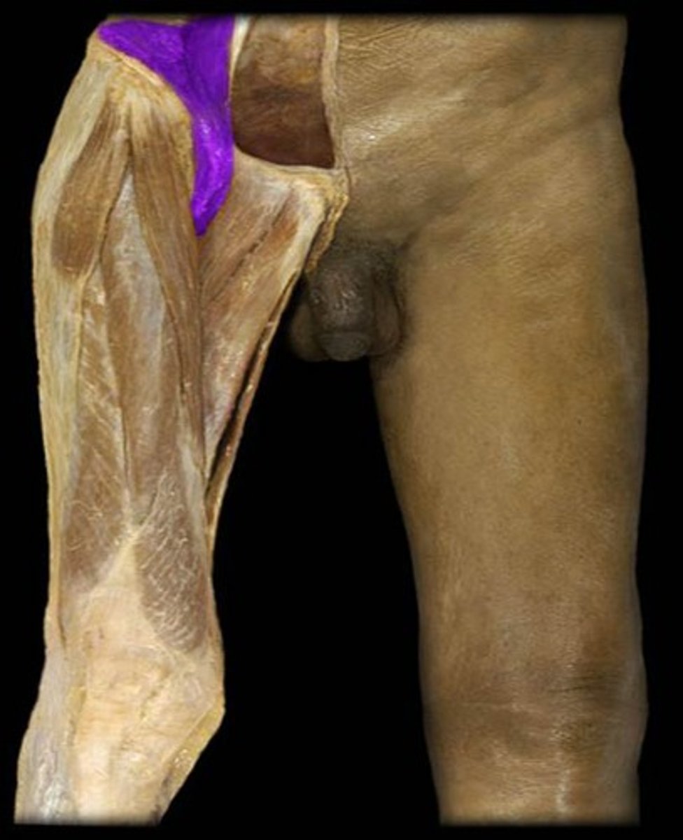 <p>What is the name of this muscle, highlighted in purple?</p>