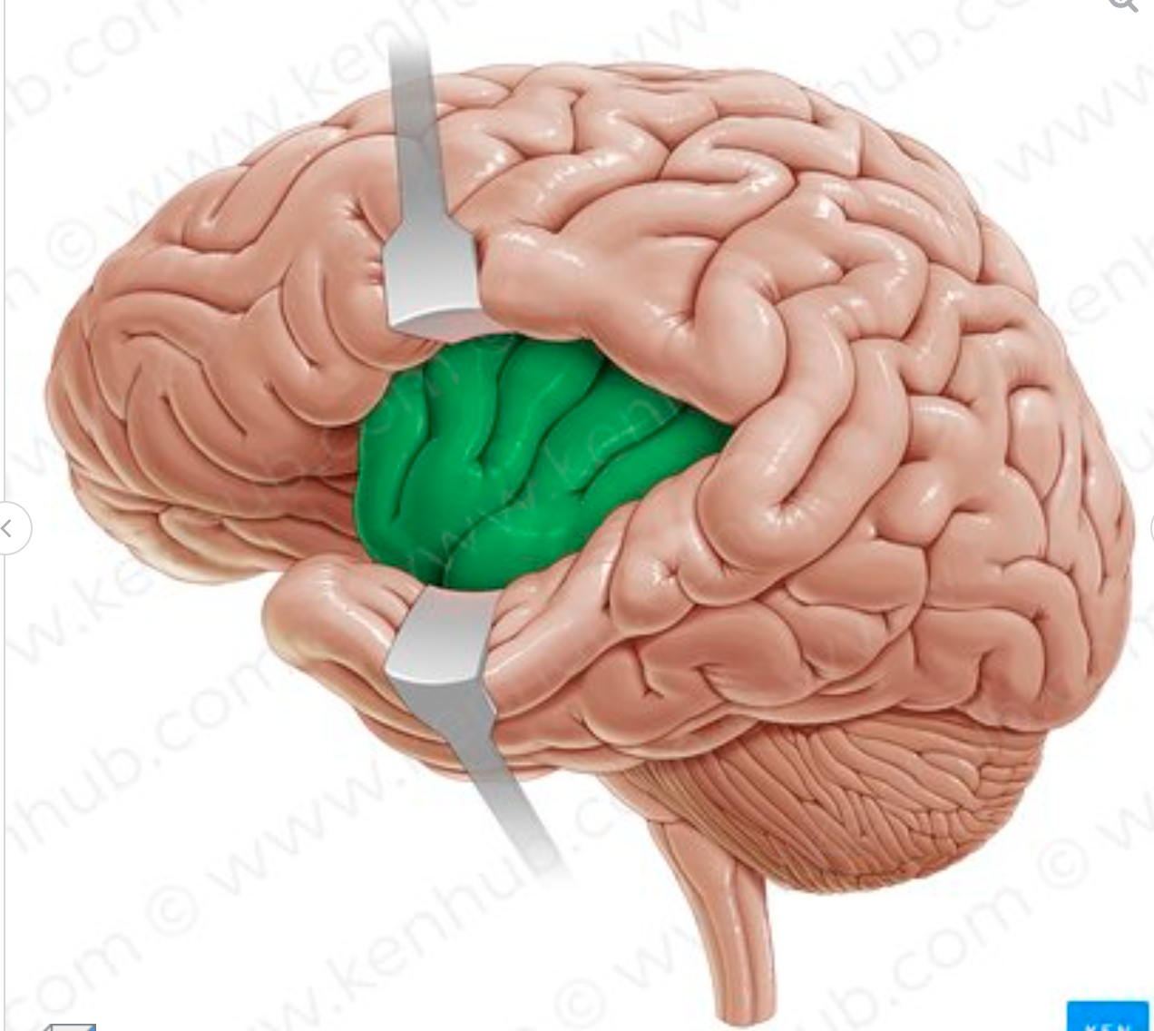 <p>What lobe is in green?</p>