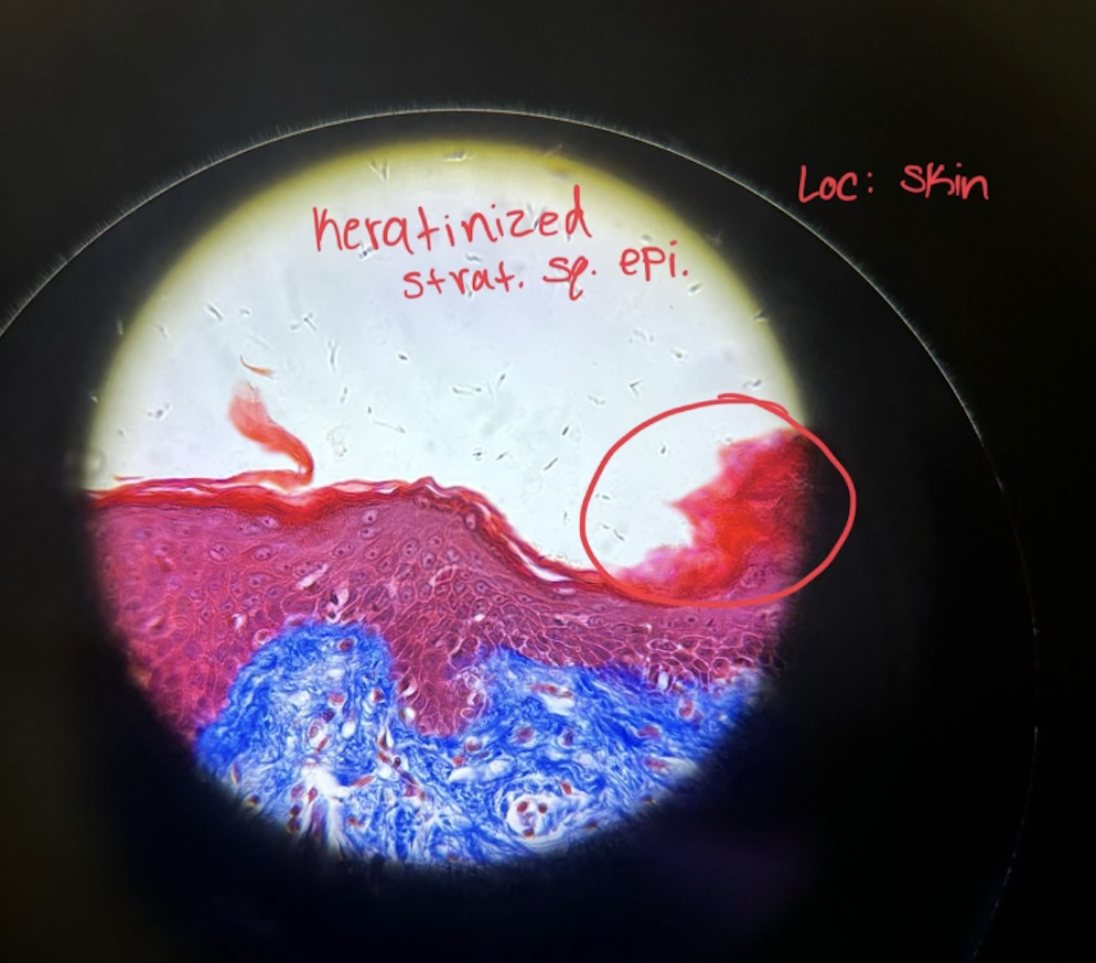 <p>Where would you find Keratinized Stratified Squamous Epi. and what does it do?</p>