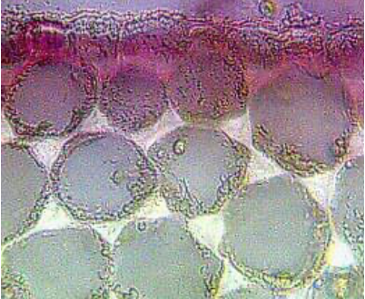 <p>What type of collenchyma cell is this?</p>