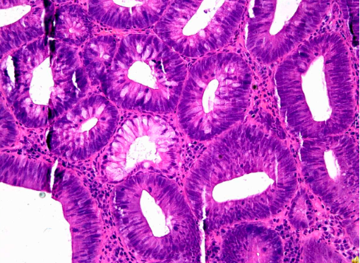 term image