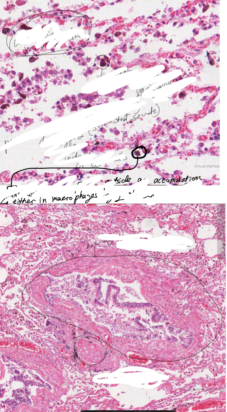 <p>What are the circled structures?</p>