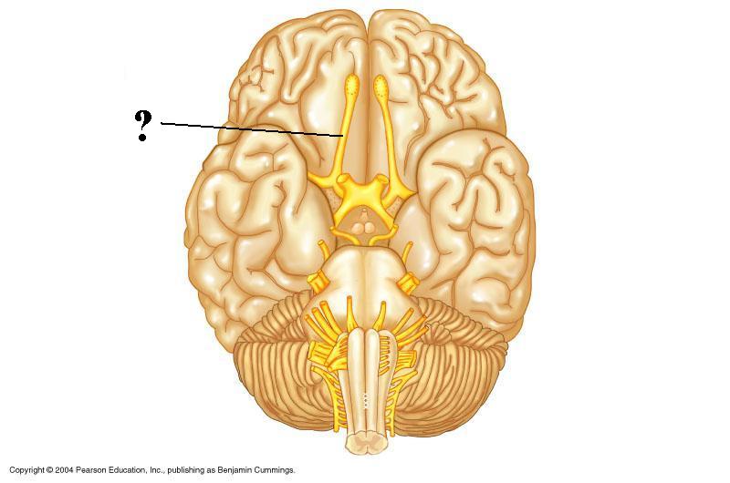 <p><span><span>Is the indicated structure composed of sensory neurons, motor neurons, or both?</span></span></p>