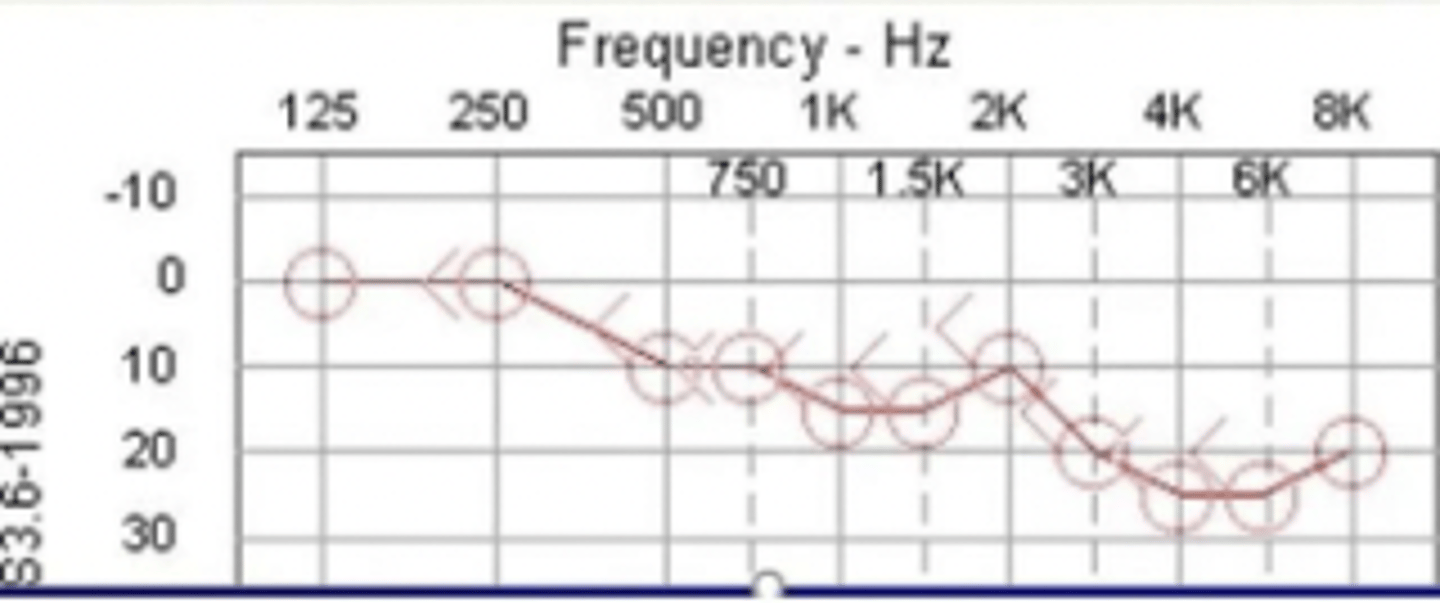 <p>What is the PTA for this audiogram?</p>