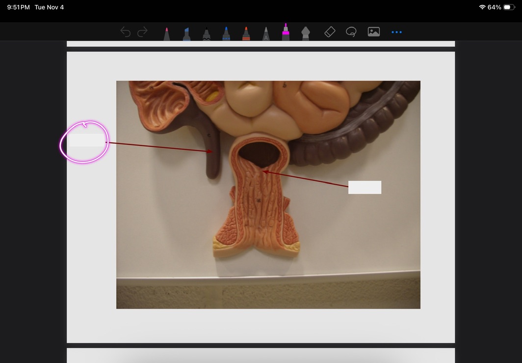 <p>What is this?</p>