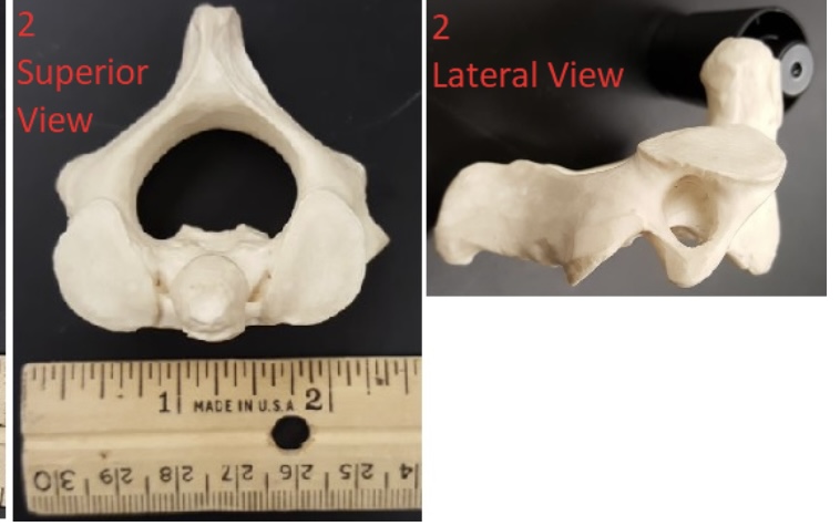 <p>2) name this specific vertebra   </p>