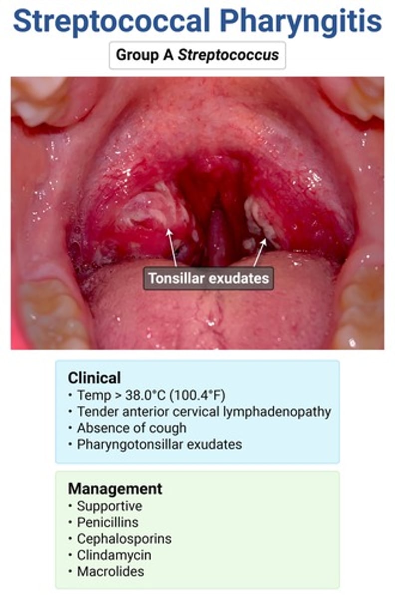 <p>acute rheumatic fever → prevented w abx</p><p>severe pharyngitis → give IM dexamethasone</p><p>post-strep GN</p><p>peritonsillar abscess</p><p>PANDAS → ped autoimmune neuropsych d/o assoc w strep</p>