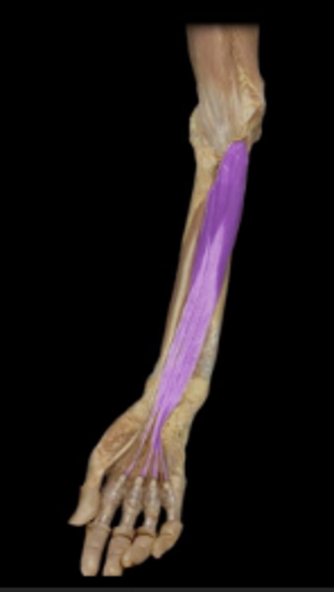 <p>action: flexion of wrist, metacarpophalangeal joints, and distal interphalangeal joints.</p>