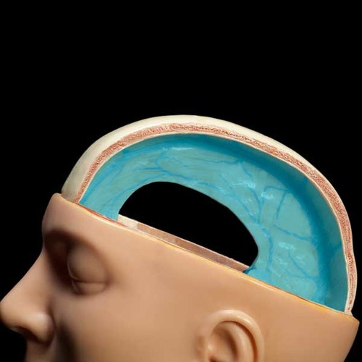 <p>separates the two cerebral hemispheres</p>