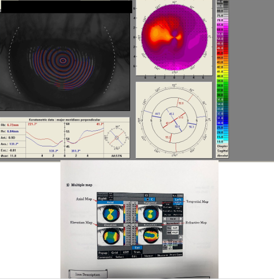 <ul><li><p>Study normal corneal topography</p></li><li><p>Study effects of disease</p></li><li><p>Pre- and post-surgical comparisons</p></li><li><p>Assess effects of contact lenses</p></li><li><p>Compare changes with refractive surgery</p></li><li><p>Document changes with orthokeratology</p></li><li><p>Aid design of customised contact lenses</p></li><li><p>Check whether the topographer measures anterior only or both anterior and posterior surfaces</p></li></ul><p></p>