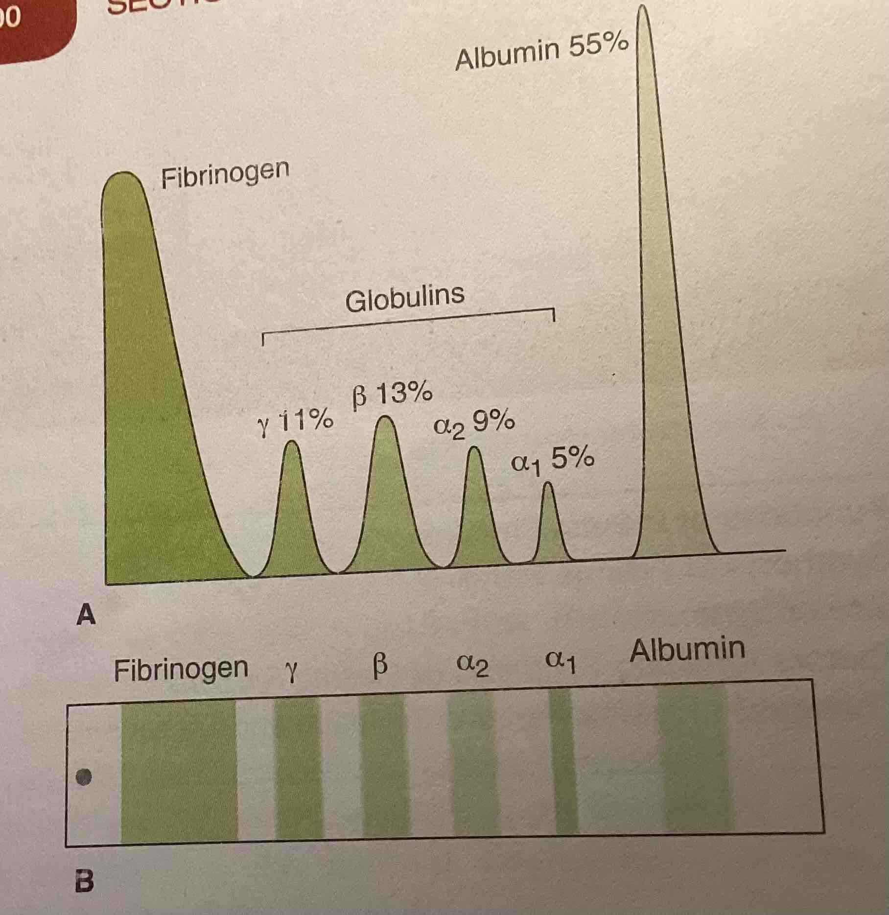 <p>Basis of paper electrophoresis proteins are identified</p>