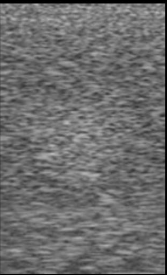 Identify the echogenicity
