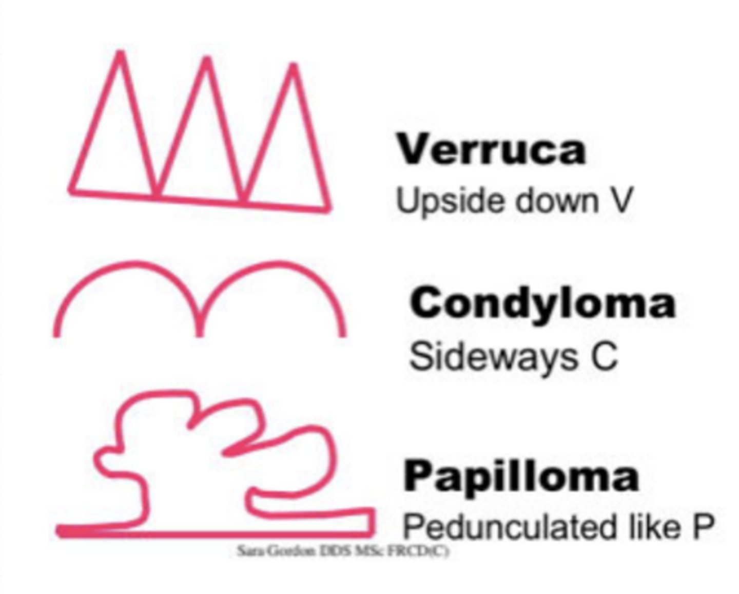 <p>Depends of HPV type</p><p>- Verruca vulgaris</p><p>- Condylomas</p><p>- Squamous cell papillomas</p><p>- Squamous cell carcinoma</p>