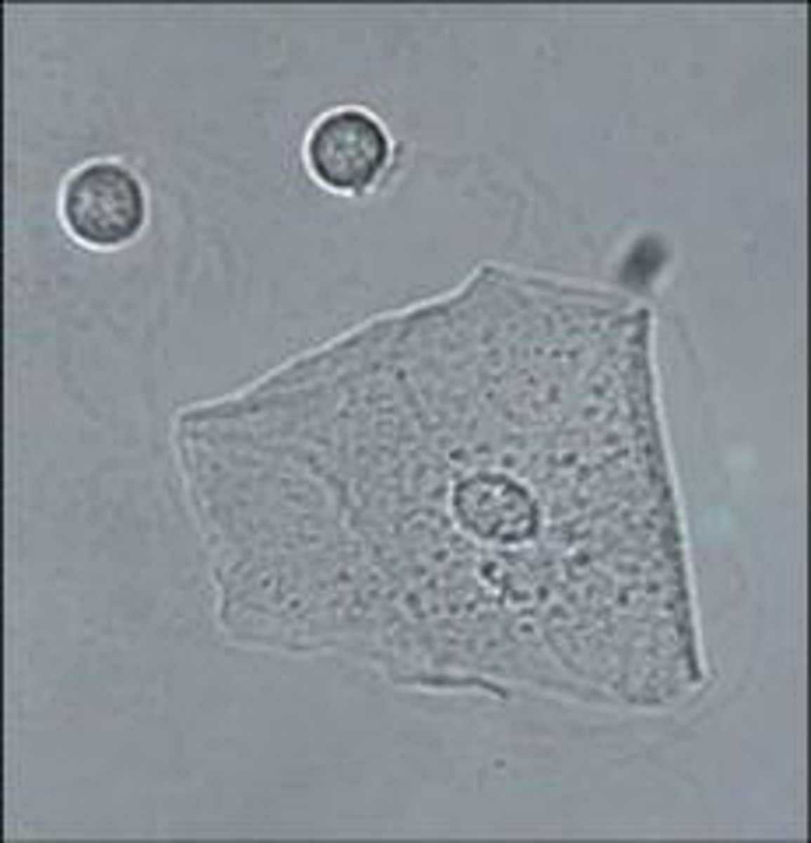 <p>Squamous Epithelial Cells</p>