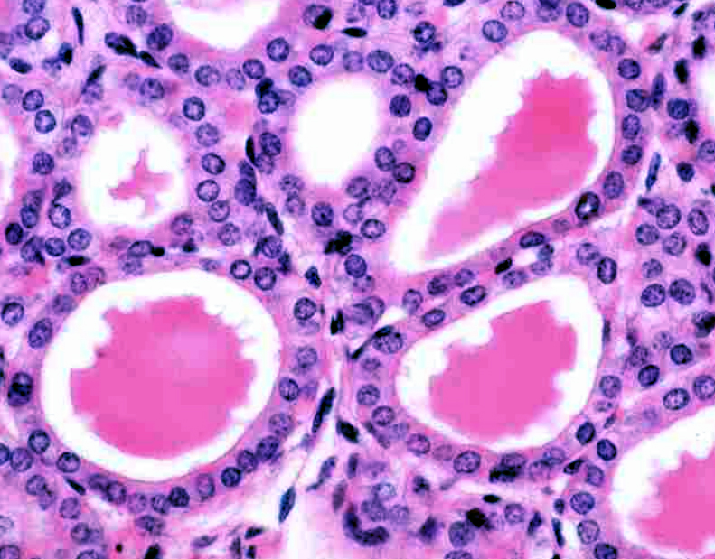 <p><span style="font-size: large">Observe the histological pattern of this specimen and select the correct identification from the list.</span></p><p><span style="font-size: large">a) adrenal gland</span></p><p><span style="font-size: large">b) thyroid gland</span></p><p><span style="font-size: large">c) pituitary gland</span></p><p><span style="font-size: large">d) parathyroid gland</span></p><p><span style="font-size: large">e) pancreas</span></p>