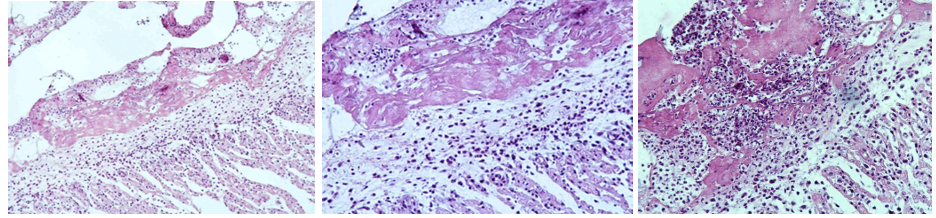 <p>This is?</p><img src="https://knowt-user-attachments.s3.amazonaws.com/98c15e13-b8d9-471c-a1e4-27e73631deb9.png" data-width="50%" data-align="center"><p></p>