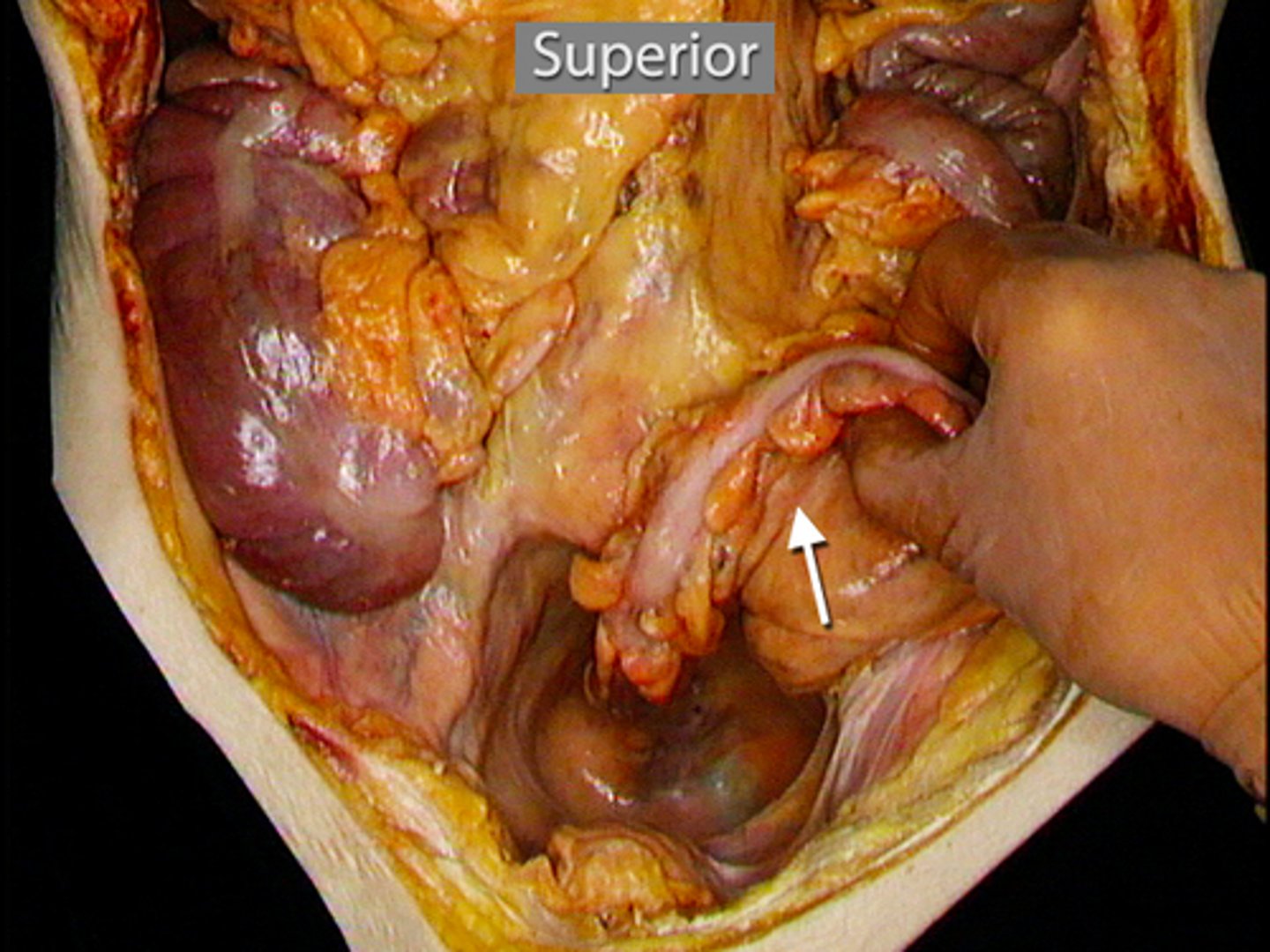 <p>What is this?</p>