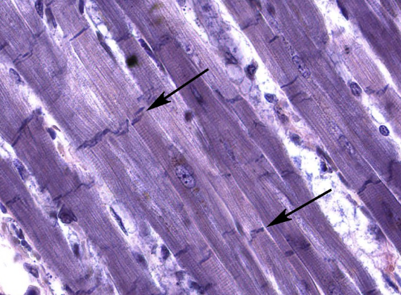 <p>What are these arrows pointing to?</p>