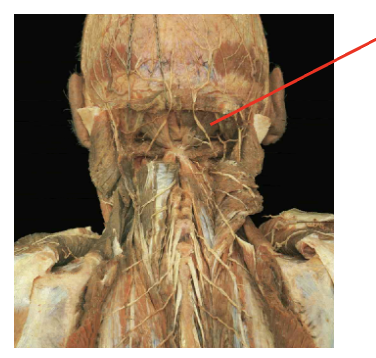 <p>What is this muscle: What is its origin. Where does it inserts.</p>