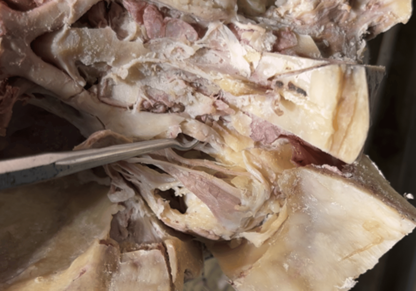 <p>On the medial side of the eye the top muscle is the</p>