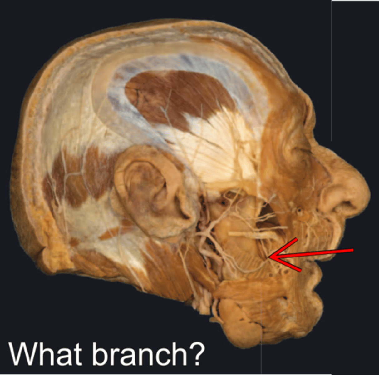 <p>What is displayed?</p>