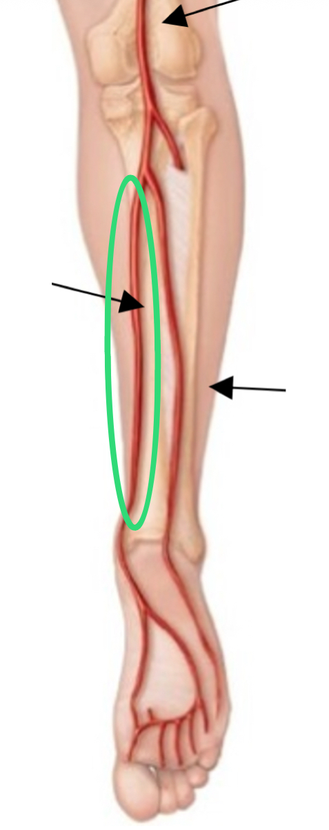 <p>popliteal artery splits into forearm forearm posterior leg </p>