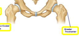 <p>proximal femur</p>