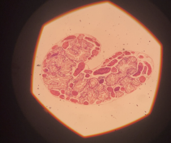 <p>first stage of larvae fasciola hepatica</p><p>no mouth or digestive system</p><p>gets nutrients directly from host</p>