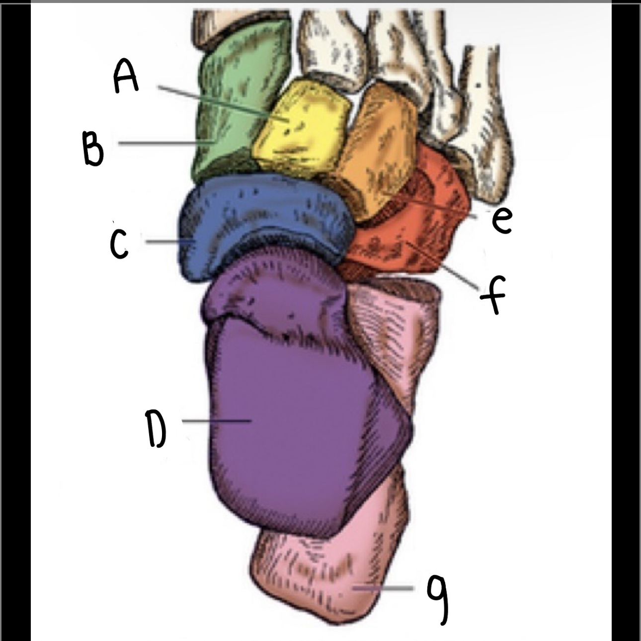 <p>What is letter E pointing to?</p>