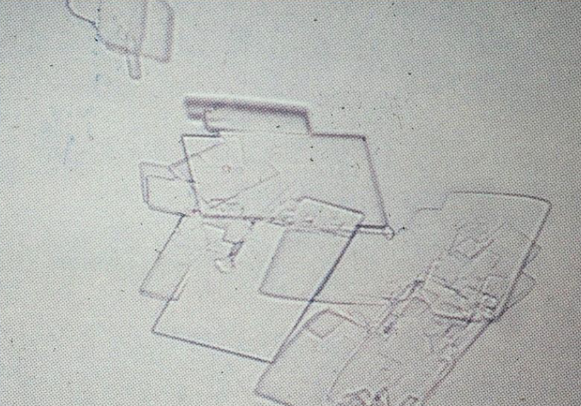 <p>What is this crystal?</p><p>Does it like acidic or alkaline urine?</p>