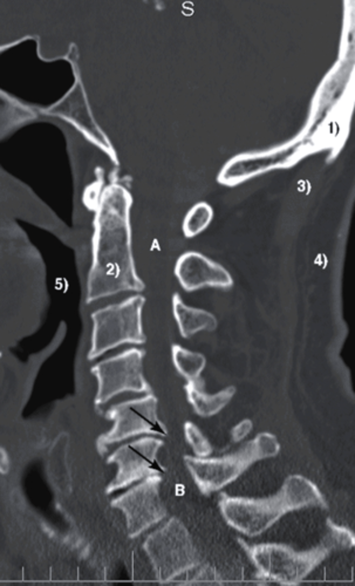 <p>what type of imaging study is this?</p><p>a.MRI</p><p>b. CT</p><p>c. Bone Scan</p><p>d. diagnostic ultrasound</p>