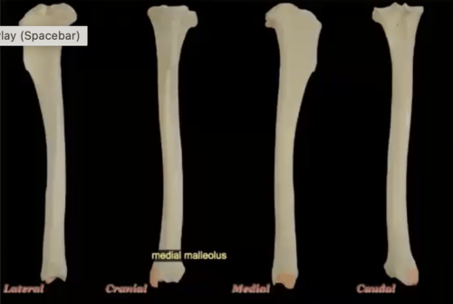 <p>medial process on distal end, forms medial bump of ankle</p>