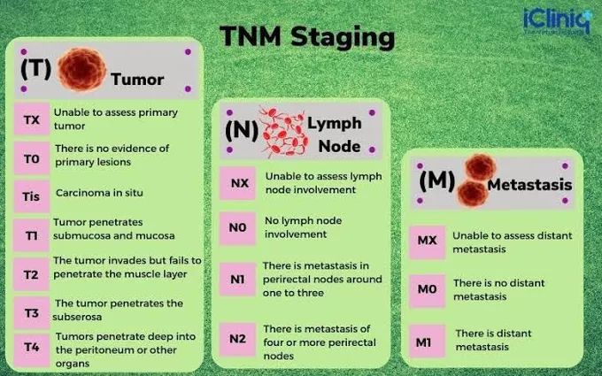 <p>TNM</p>