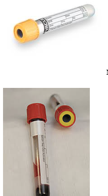 <p>Serum Seperator = Tiger Top</p>