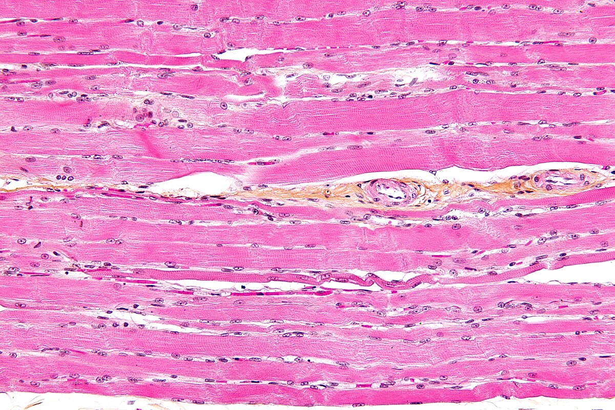 <p>What type of tissue is this?</p>